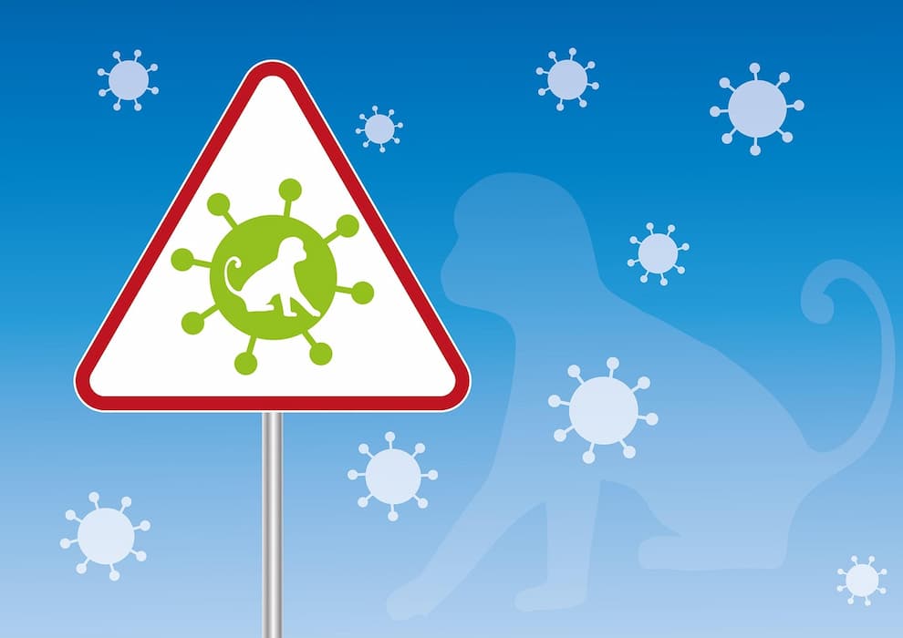 Image principale de Mpox à Mayotte : six cas confirmés, la vigilance sanitaire renforcée